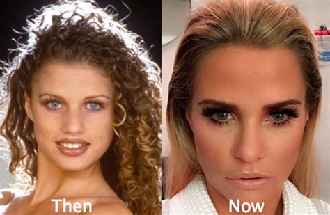 katie price teeth before and after|Katie Prices full plastic surgery over 25 years after glamour ...